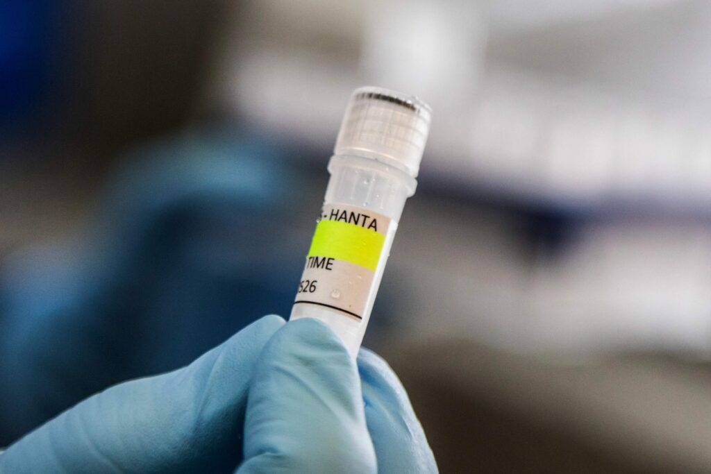WHO: Hantaviruksen leviämisriski risteilyaluksen ulkopuolelle pieni – viisi tartuntaa vahvistettu